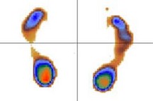 gráfico informatizado de una pisada
